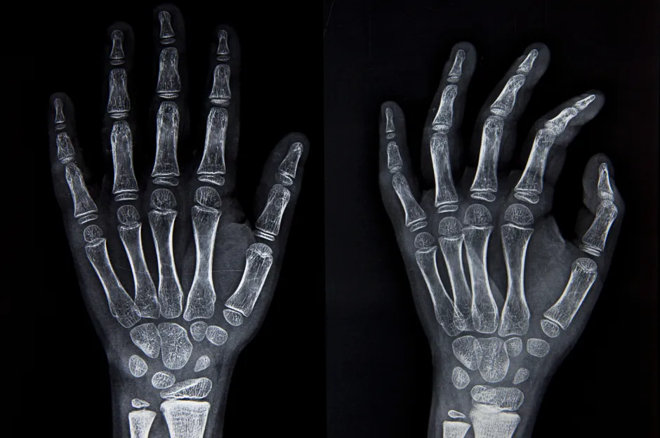 Early X-ray, a Victorian-era invention